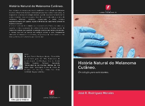História Natural do Melanoma Cutâneo.