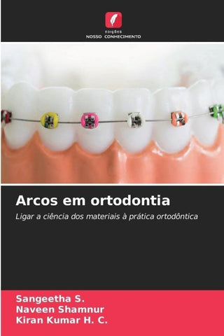 Arcos em ortodontia