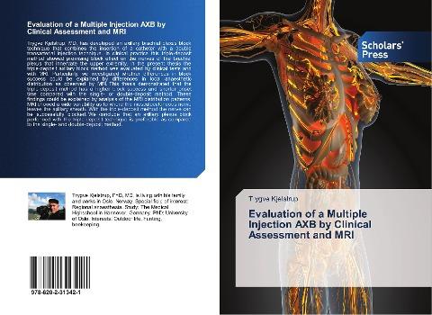 Evaluation of a Multiple Injection AXB by Clinical Assessment and MRI