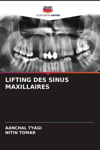 LIFTING DES SINUS MAXILLAIRES