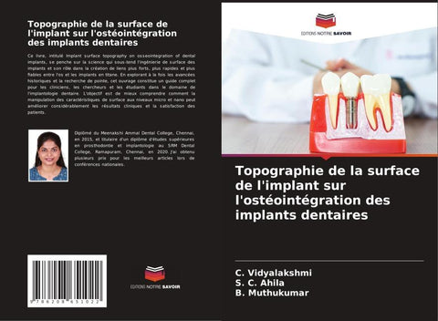Topographie de la surface de l'implant sur l'ostéointégration des implants dentaires