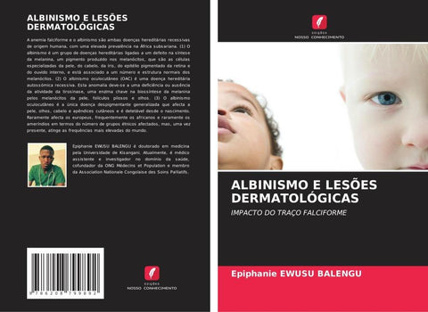 ALBINISMO E LESÕES DERMATOLÓGICAS