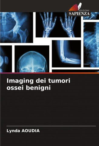 Imaging dei tumori ossei benigni