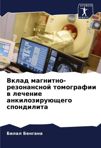 Vklad magnitno-rezonansnoj tomografii w lechenie ankiloziruüschego spondilita