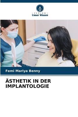ÄSTHETIK IN DER IMPLANTOLOGIE