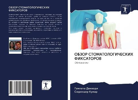 OBZOR STOMATOLOGIChESKIH FIKSATOROV