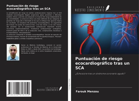 Puntuación de riesgo ecocardiográfico tras un SCA
