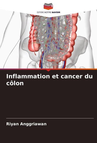 Inflammation et cancer du côlon