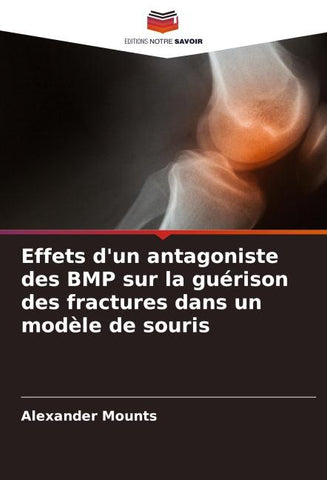 Effets d'un antagoniste des BMP sur la guérison des fractures dans un modèle de souris