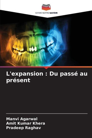 L'expansion : Du passé au présent