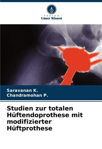 Studien zur totalen Hüftendoprothese mit modifizierter Hüftprothese
