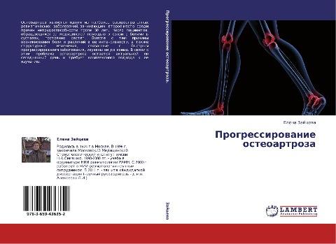 Progressirowanie osteoartroza