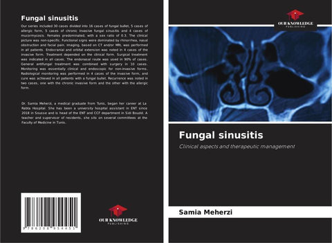 Fungal sinusitis