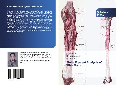 Finite Element Analysis of Tibia Bone