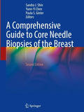 A Comprehensive Guide to Core Needle Biopsies of the Breast