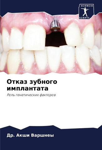 Otkaz zubnogo implantata