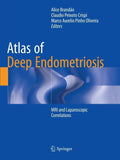Atlas of Deep Endometriosis