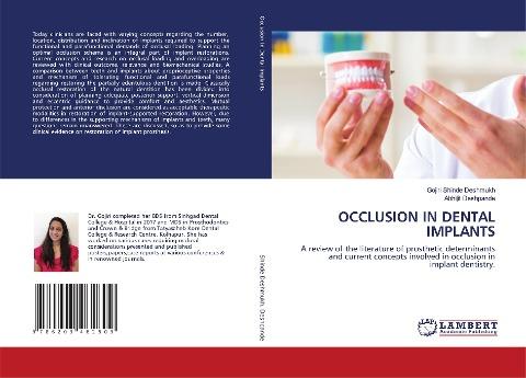 OCCLUSION IN DENTAL IMPLANTS
