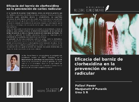 Eficacia del barniz de clorhexidina en la prevención de caries radicular