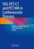 FDG-PET/CT and PET/MR in Cardiovascular Diseases
