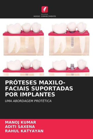 PRÓTESES MAXILO-FACIAIS SUPORTADAS POR IMPLANTES