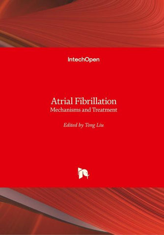 Atrial Fibrillation