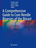 A Comprehensive Guide to Core Needle Biopsies of the Breast
