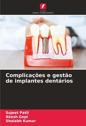 Complicações e gestão de implantes dentários