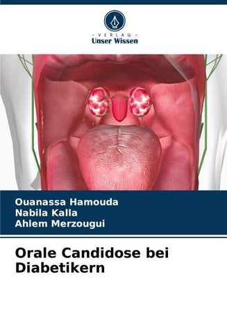 Orale Candidose bei Diabetikern