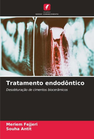 Tratamento endodôntico