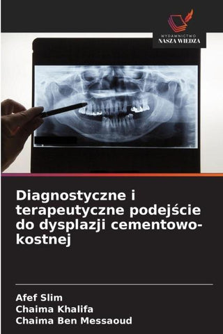 Diagnostyczne i terapeutyczne podej¿cie do dysplazji cementowo-kostnej