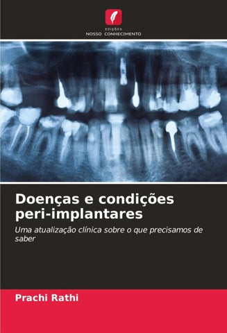 Doenças e condições peri-implantares