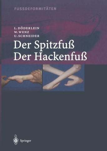 Fussdeformitäten