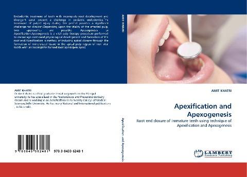 Apexification and Apexogenesis