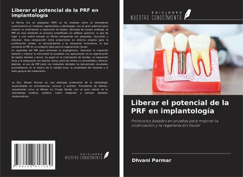 Liberar el potencial de la PRF en implantología