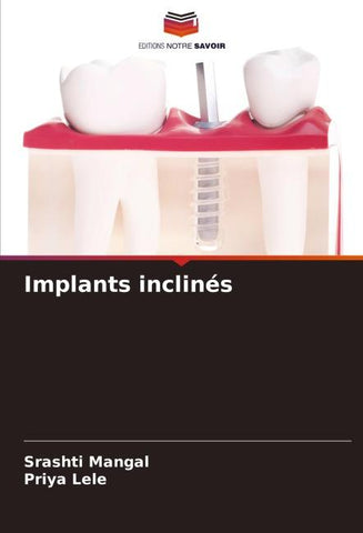 Implants inclinés