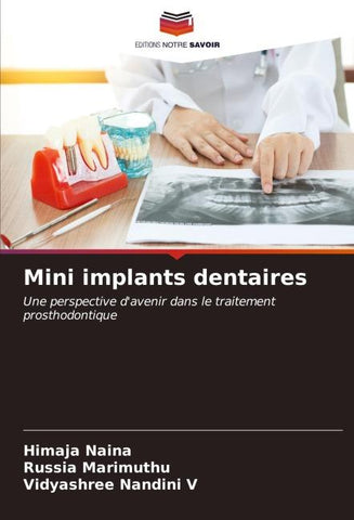 Mini implants dentaires