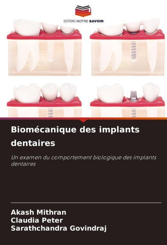 Biomécanique des implants dentaires