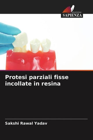Protesi parziali fisse incollate in resina