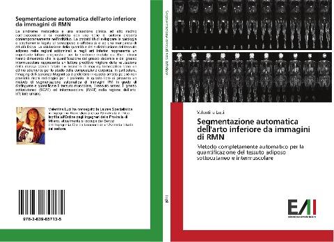 Segmentazione automatica dell'arto inferiore da immagini di RMN