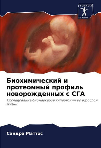 Biohimicheskij i proteomnyj profil' noworozhdennyh s SGA