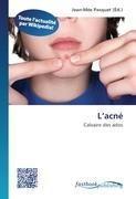 L'acné