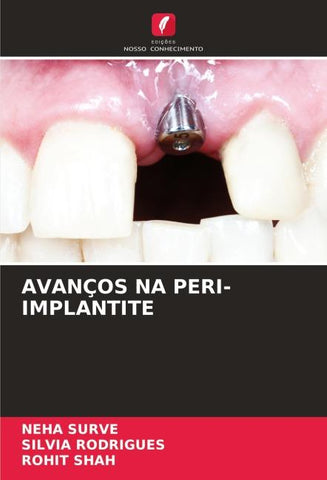 AVANÇOS NA PERI-IMPLANTITE