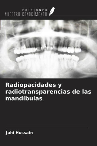 Radiopacidades y radiotransparencias de las mandíbulas
