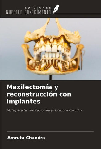 Maxilectomía y reconstrucción con implantes