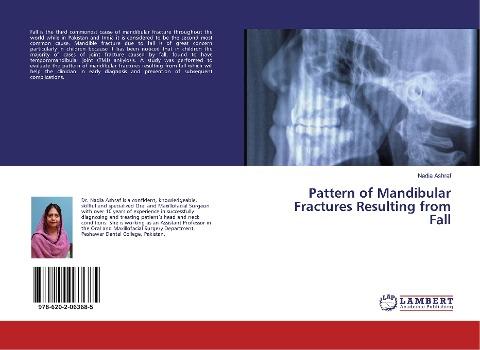 Pattern of Mandibular Fractures Resulting from Fall