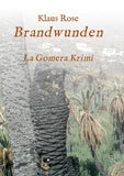 Brandwunden