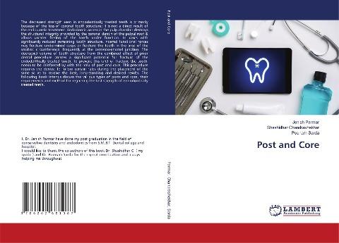 Post and Core