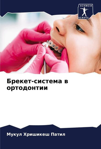 Breket-sistema w ortodontii