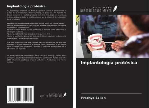 Implantología protésica